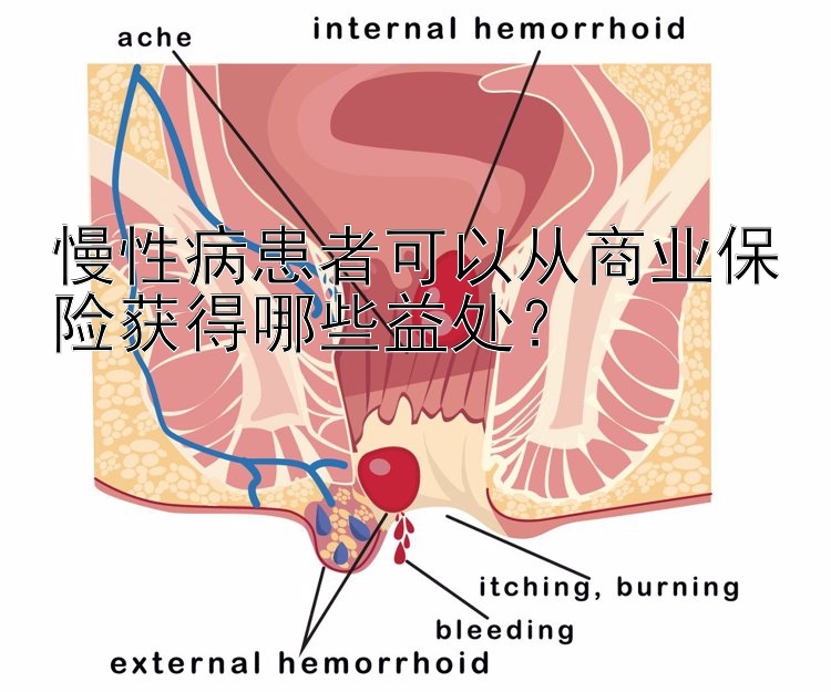 慢性病患者可以从商业保险获得哪些益处？