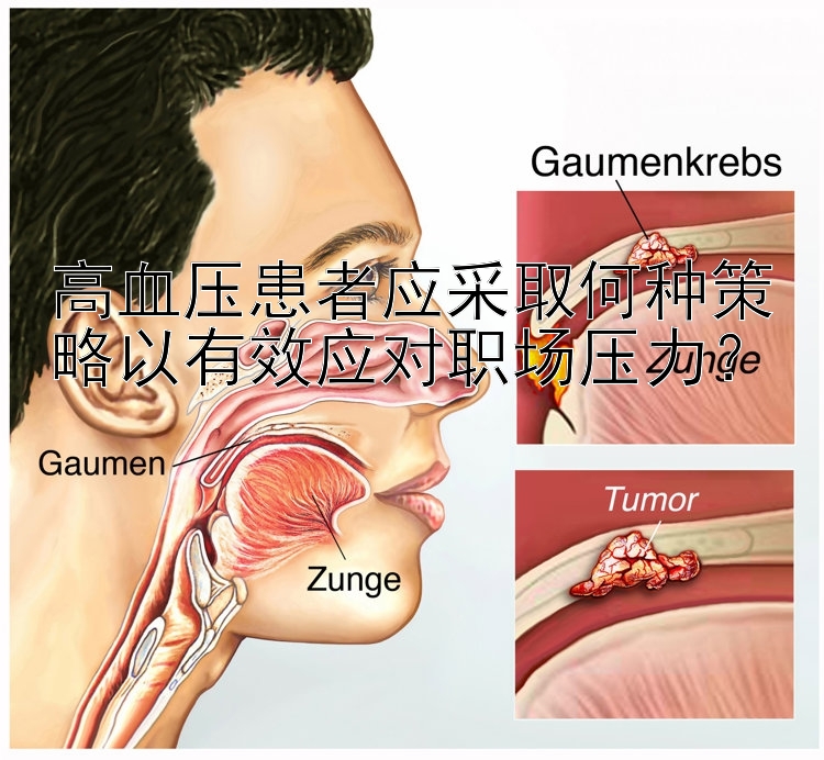 高血压患者应采取何种策略以有效应对职场压力？