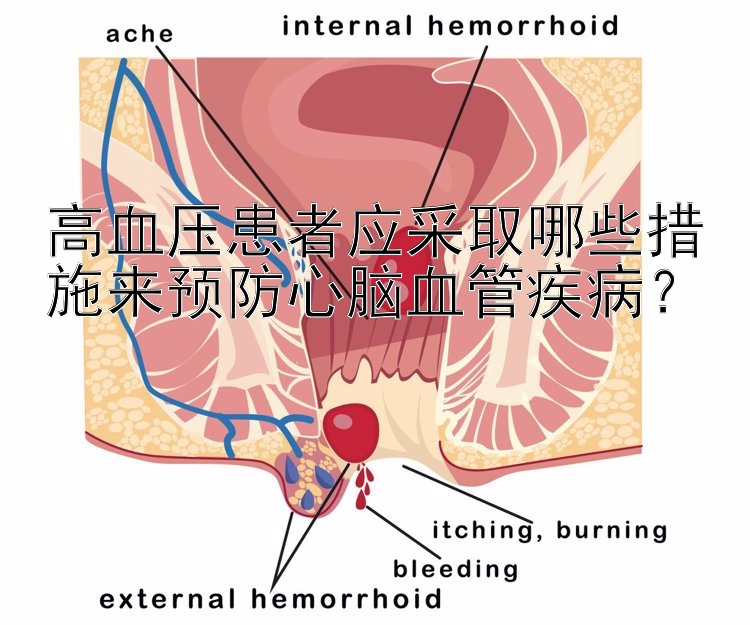 高血压患者应采取哪些措施来预防心脑血管疾病？