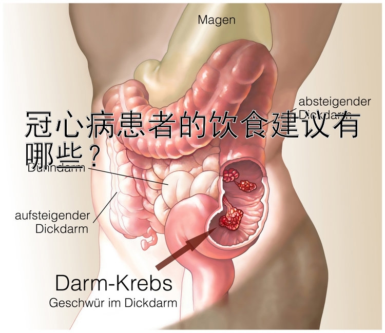 冠心病患者的饮食建议有哪些？