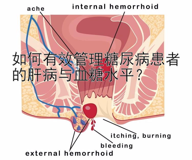 如何有效管理糖尿病患者的肝病与血糖水平？