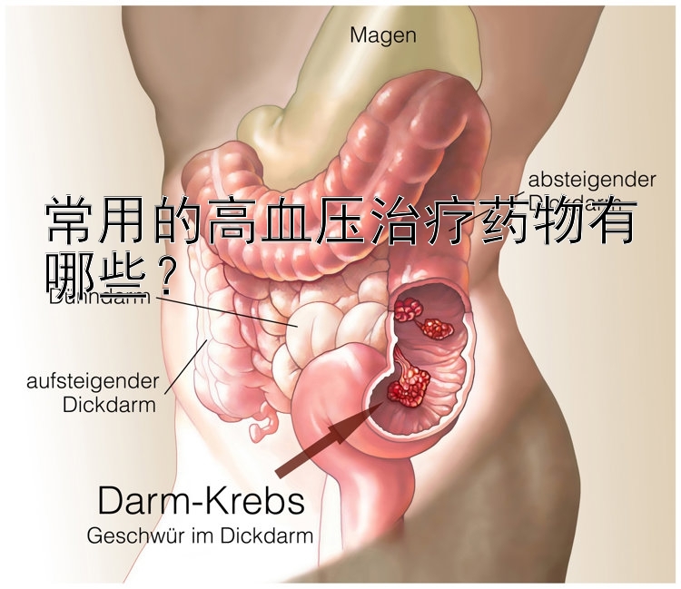 常用的高血压治疗药物有哪些？