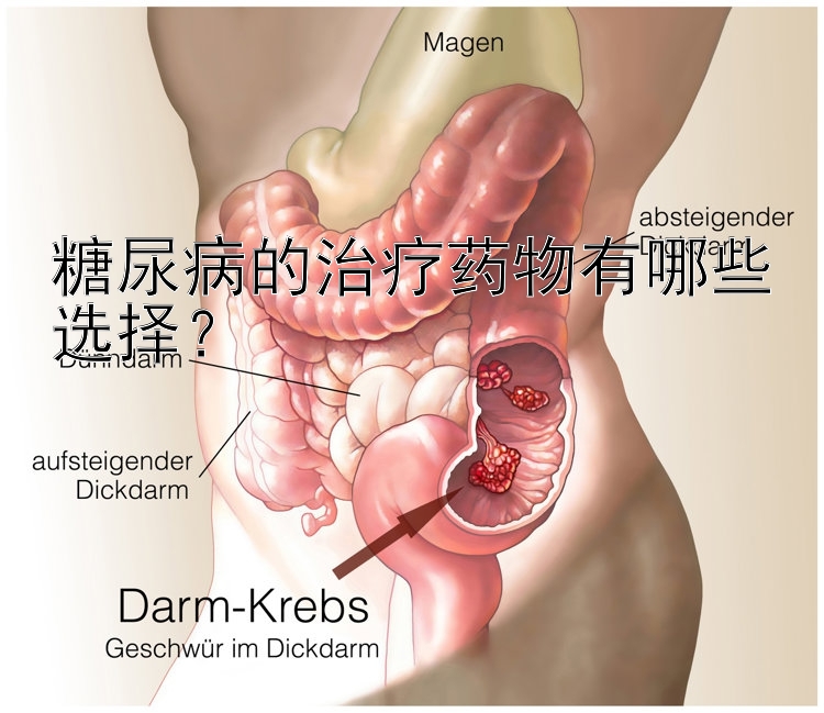 糖尿病的治疗药物有哪些选择？