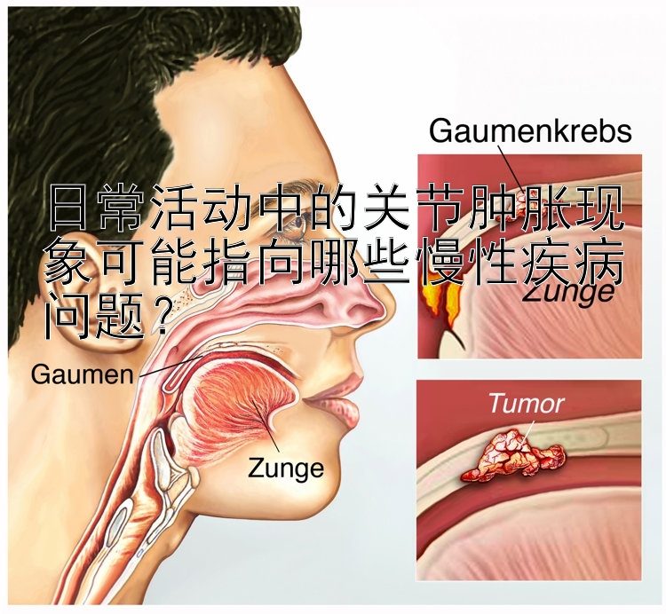 日常活动中的关节肿胀现象可能指向哪些慢性疾病问题？