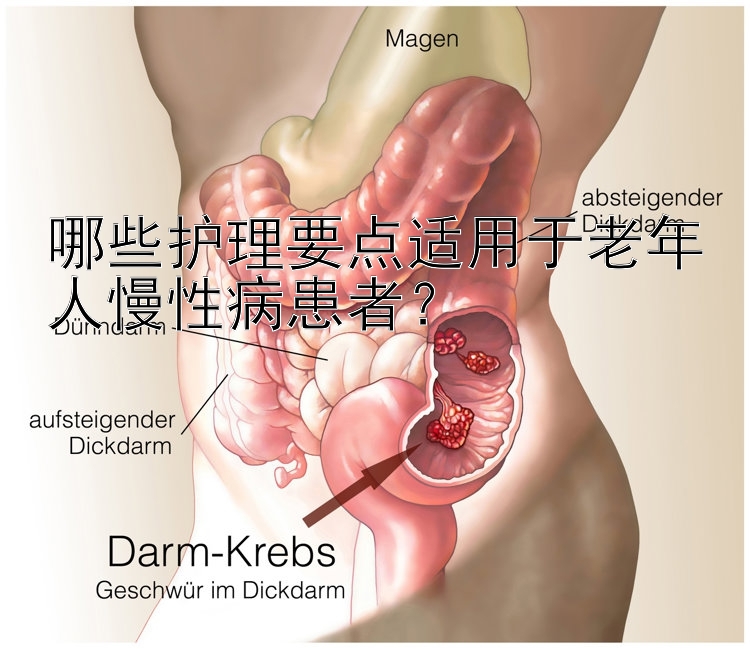 哪些护理要点适用于老年人慢性病患者？