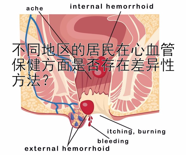 不同地区的居民在心血管保健方面是否存在差异性方法？