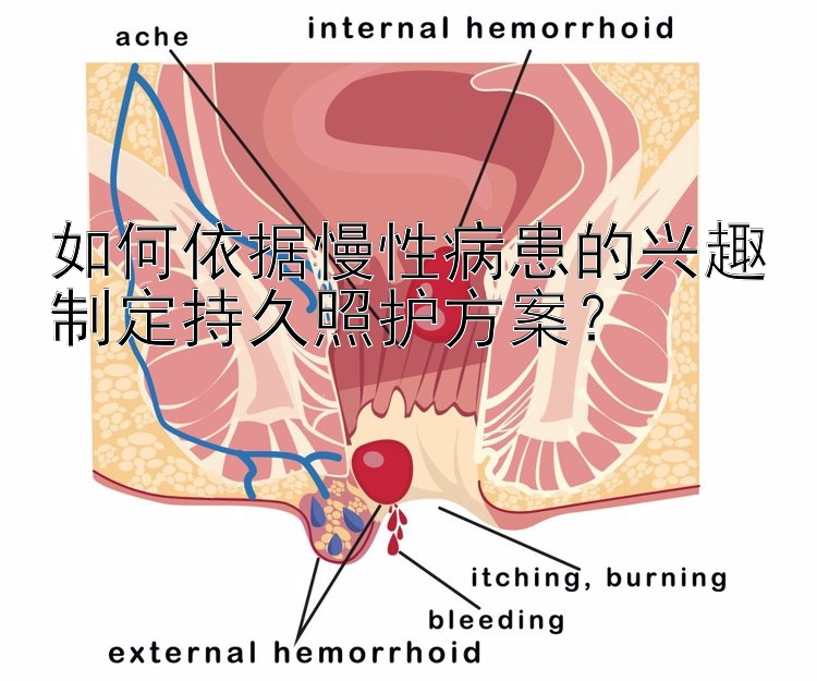 pk10肯定有规律 如何依据慢性病患的兴趣制定持久照护方案？