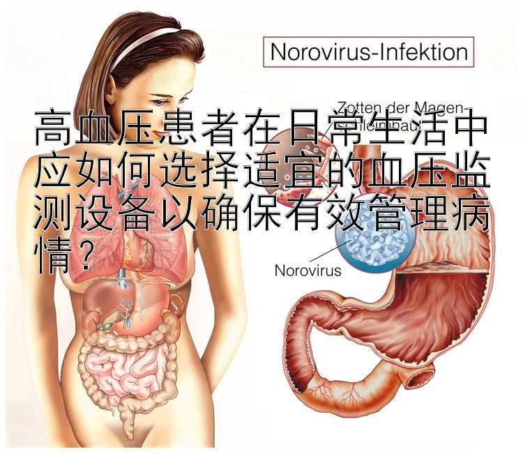 高血压患者在日常生活中应如何选择适宜的血压监测设备以确保有效管理病情？