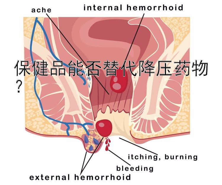 保健品能否替代降压药物？