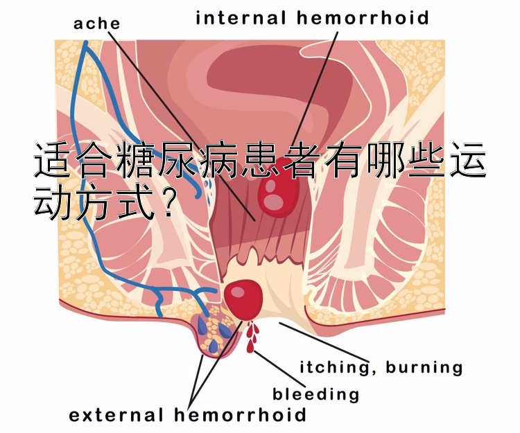 适合糖尿病患者有哪些运动方式？