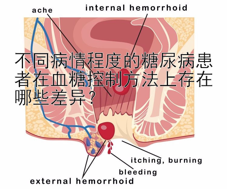 不同病情程度的糖尿病患者在血糖控制方法上存在哪些差异？