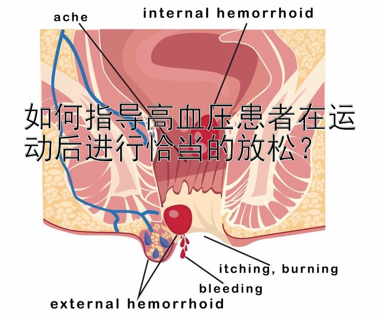 如何指导高血压患者在运动后进行恰当的放松？