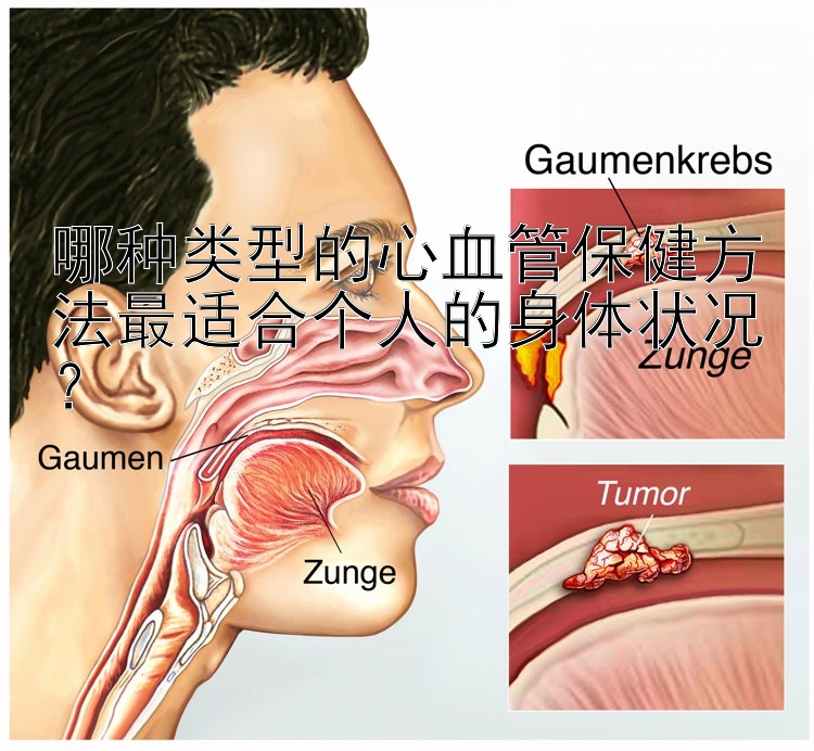 哪种类型的心血管保健方法最适合个人的身体状况？