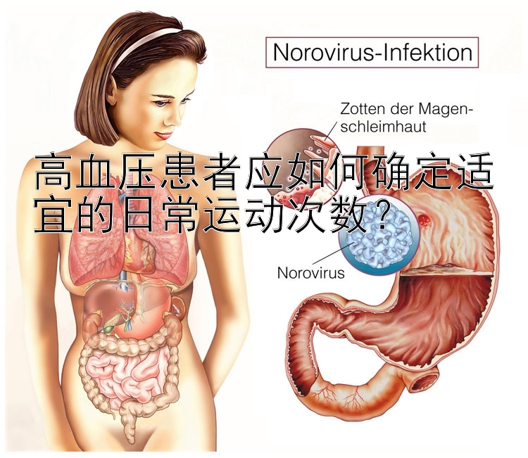 高血压患者应如何确定适宜的日常运动次数？