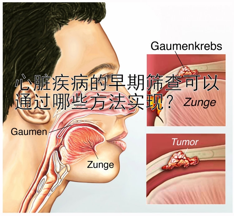 心脏疾病的早期筛查可以通过哪些方法实现？